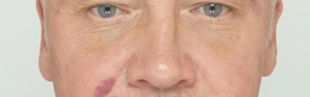 Полиция ищет пропавшего в Таллинне мужчину