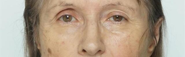 Полиция просит помощи в поисках 73-летней Фаины, пропавшей в Ласнамяэ