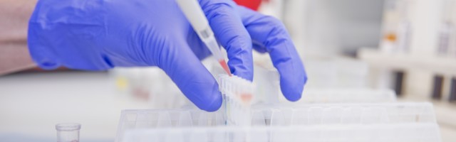 SYNLAB начнет проводить тестирование на коронавирус по новой методике