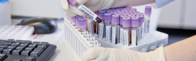 SYNLAB обновила методику анализов на антитела против коронавируса