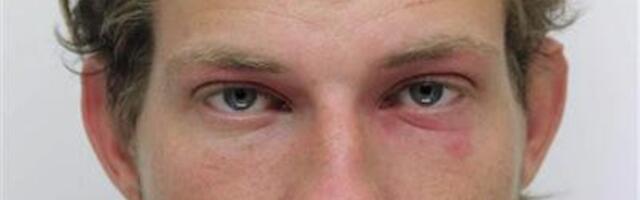 Полиция просит помощи в поисках пропавшего в Ляэне-Вирумаа 35-летнего Андреса