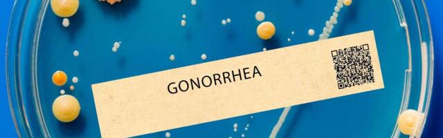Медики подчеркивают: даже при отсутствии симптомов гонорея может нанести сильный вред здоровью