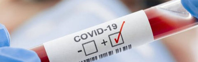 За сутки добавилось 855 новых случаев коронавируса, скончались девять человек