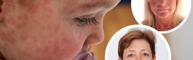 Эксперты бьют тревогу: распространение кори в Эстонии показывает, что уровень вакцинации упал ниже критического порога