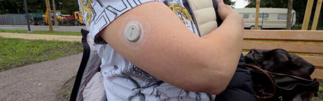 "Зеркало": диабетику не хотят выписывать рецепт на сенсор для измерения уровня глюкозы