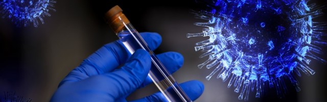 82 новых случая инфицирования коронавирусом