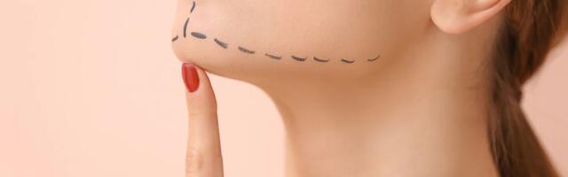 После 30: какие мини-операции делают, чтобы выглядеть свежо, а не «переделанно»