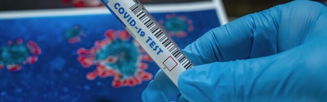 В Эстонии выявлен 191 новый случай заражения коронавирусом, 3 человека скончались