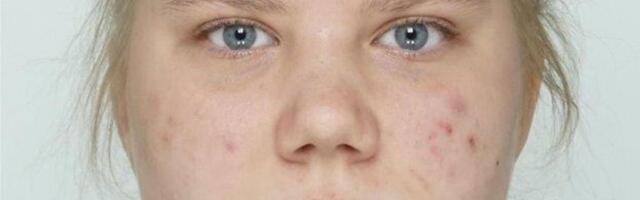 Полиция просит помощи в поисках 16-летней Кяролин