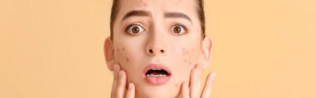 Четыре стадии стресса и признаки каждой на женском лице