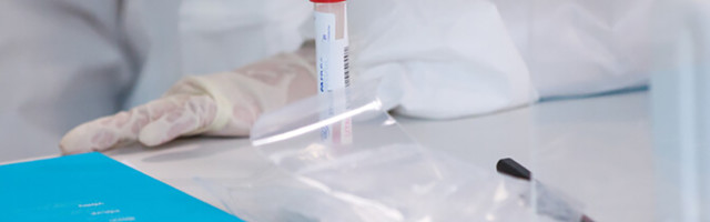 За сутки добавилось 290 новых случаев коронавируса, скончались четверо