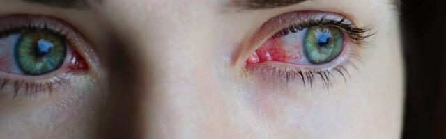 Новый штамм коронавируса с необычным симптомом: есть ли он в Эстонии?